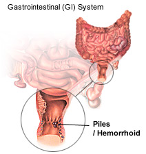 Anus With Piles